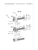 ADAPTIVE SPINAL ROD AND METHODS FOR STABILIZATION OF THE SPINE diagram and image