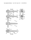 ADAPTIVE SPINAL ROD AND METHODS FOR STABILIZATION OF THE SPINE diagram and image