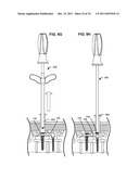 ADAPTIVE SPINAL ROD AND METHODS FOR STABILIZATION OF THE SPINE diagram and image