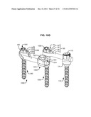 ADAPTIVE SPINAL ROD AND METHODS FOR STABILIZATION OF THE SPINE diagram and image