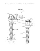 ADAPTIVE SPINAL ROD AND METHODS FOR STABILIZATION OF THE SPINE diagram and image