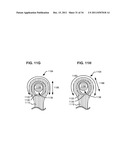 ADAPTIVE SPINAL ROD AND METHODS FOR STABILIZATION OF THE SPINE diagram and image