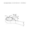 ADAPTIVE SPINAL ROD AND METHODS FOR STABILIZATION OF THE SPINE diagram and image