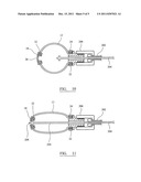 BONE CAVITY SUPPORT STRUCTURE ASSEMBLY diagram and image