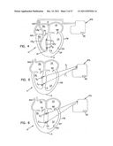 SYSTEMS, DEVICES AND METHODS FOR MONITORING EFFICIENCY OF PACING diagram and image