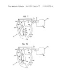 SYSTEMS, DEVICES AND METHODS FOR MONITORING EFFICIENCY OF PACING diagram and image