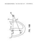 SYSTEMS, DEVICES AND METHODS FOR MONITORING EFFICIENCY OF PACING diagram and image