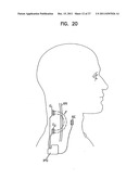 SYSTEMS, DEVICES AND METHODS FOR MONITORING EFFICIENCY OF PACING diagram and image