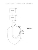 SYSTEMS, DEVICES AND METHODS FOR MONITORING EFFICIENCY OF PACING diagram and image