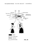 SYSTEMS, DEVICES AND METHODS FOR MONITORING EFFICIENCY OF PACING diagram and image