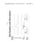 DEVICE AND IMPLANTATION SYSTEM FOR ELECTRICAL STIMULATION OF BIOLOGICAL     SYSTEMS diagram and image