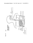 DEVICE AND IMPLANTATION SYSTEM FOR ELECTRICAL STIMULATION OF BIOLOGICAL     SYSTEMS diagram and image