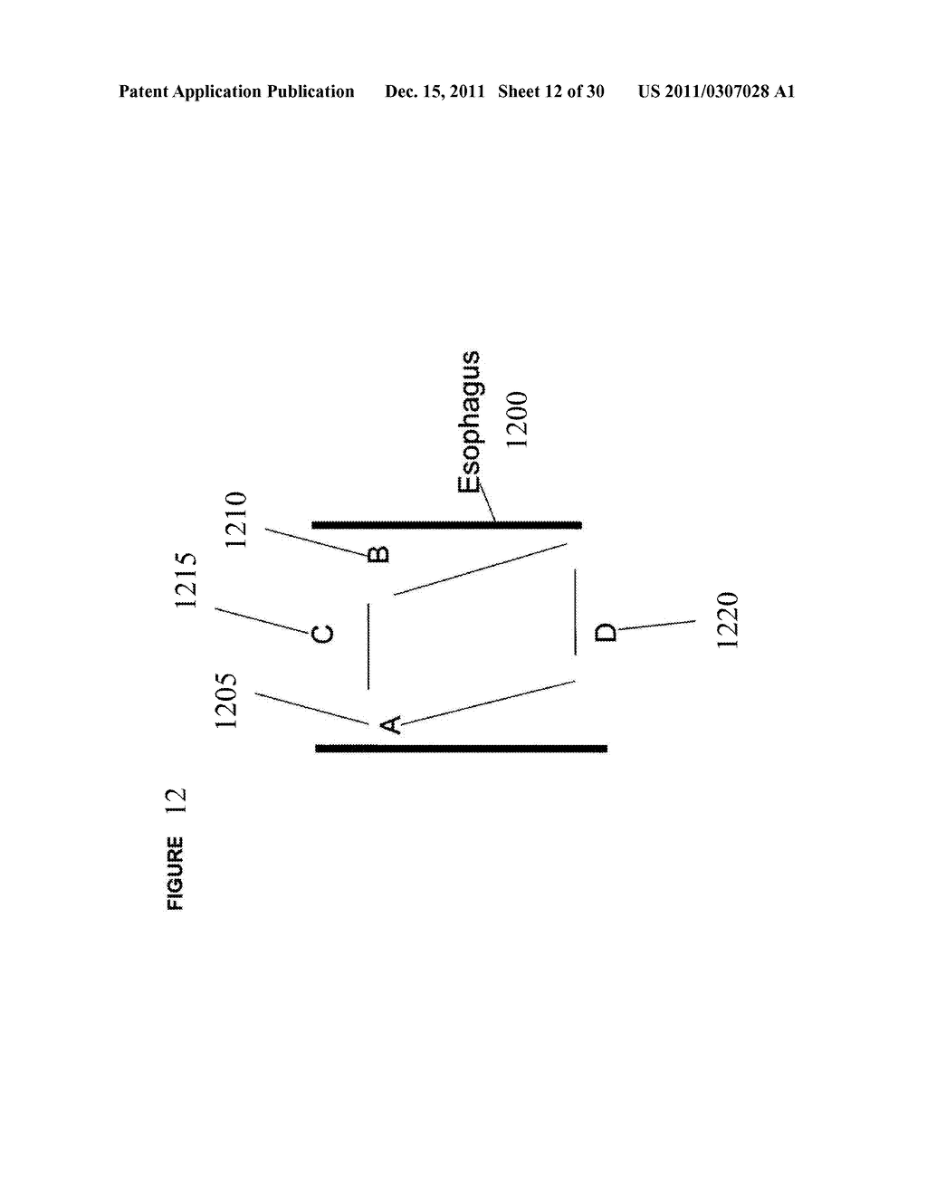 DEVICE AND IMPLANTATION SYSTEM FOR ELECTRICAL STIMULATION OF BIOLOGICAL     SYSTEMS - diagram, schematic, and image 13