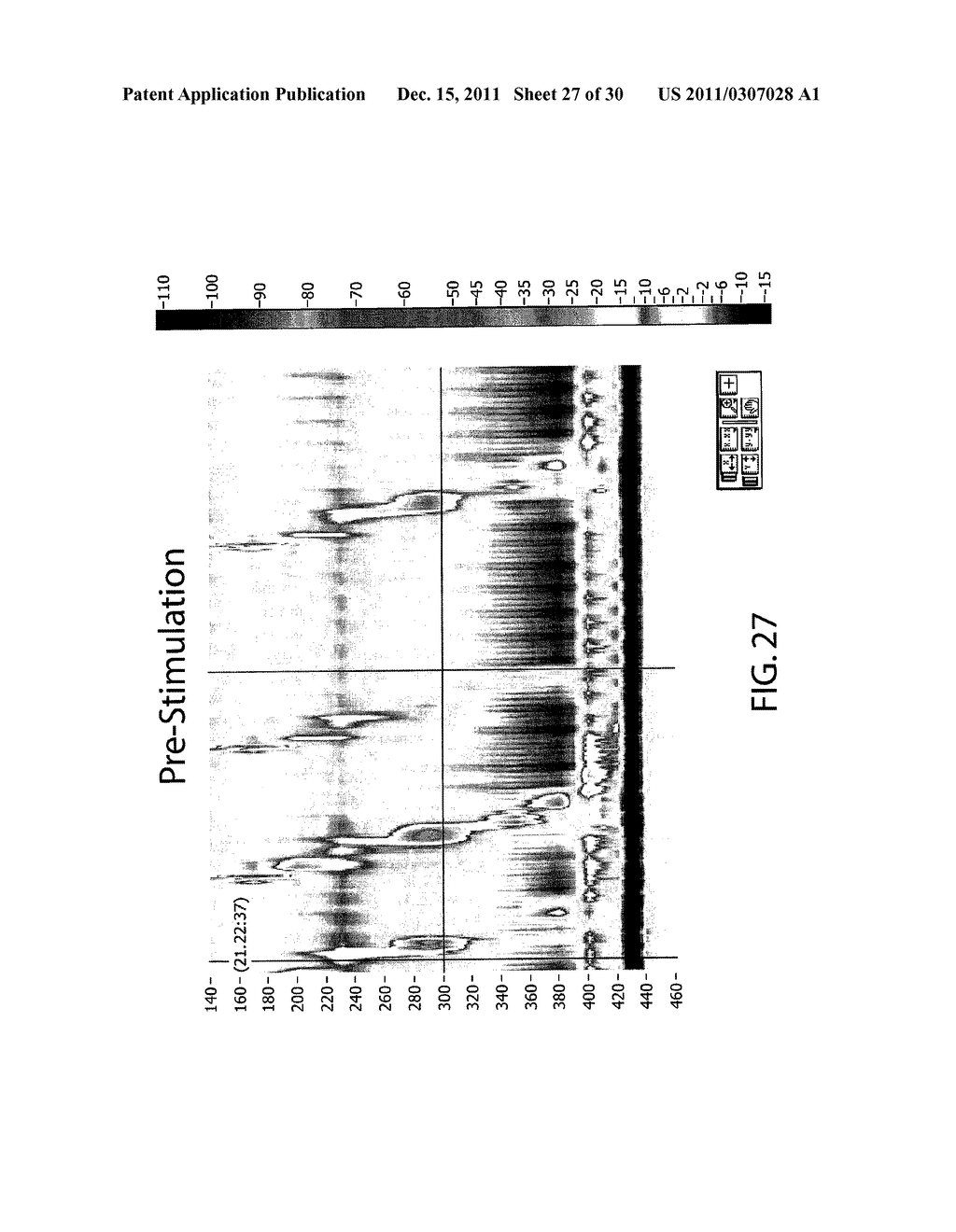 DEVICE AND IMPLANTATION SYSTEM FOR ELECTRICAL STIMULATION OF BIOLOGICAL     SYSTEMS - diagram, schematic, and image 28