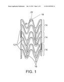 Laser System And Processing Conditions For Manufacturing Bioabsorbable     Stents diagram and image