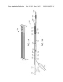 STENT ALIGNMENT DURING TREATMENT OF A BIFURCATION diagram and image