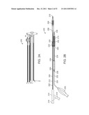 STENT ALIGNMENT DURING TREATMENT OF A BIFURCATION diagram and image