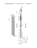 STENT ALIGNMENT DURING TREATMENT OF A BIFURCATION diagram and image