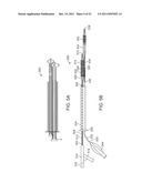 STENT ALIGNMENT DURING TREATMENT OF A BIFURCATION diagram and image