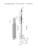 STENT ALIGNMENT DURING TREATMENT OF A BIFURCATION diagram and image