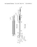 STENT ALIGNMENT DURING TREATMENT OF A BIFURCATION diagram and image