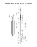 STENT ALIGNMENT DURING TREATMENT OF A BIFURCATION diagram and image