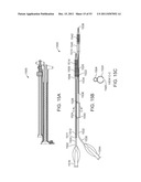 STENT ALIGNMENT DURING TREATMENT OF A BIFURCATION diagram and image