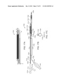 STENT ALIGNMENT DURING TREATMENT OF A BIFURCATION diagram and image