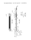 STENT ALIGNMENT DURING TREATMENT OF A BIFURCATION diagram and image