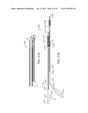 STENT ALIGNMENT DURING TREATMENT OF A BIFURCATION diagram and image