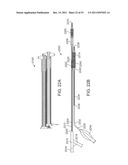 STENT ALIGNMENT DURING TREATMENT OF A BIFURCATION diagram and image