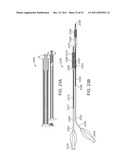 STENT ALIGNMENT DURING TREATMENT OF A BIFURCATION diagram and image