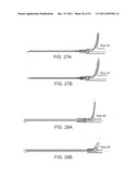 STENT ALIGNMENT DURING TREATMENT OF A BIFURCATION diagram and image