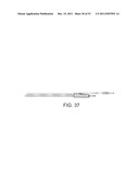 STENT ALIGNMENT DURING TREATMENT OF A BIFURCATION diagram and image