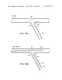 STENT ALIGNMENT DURING TREATMENT OF A BIFURCATION diagram and image