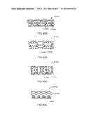 STENT ALIGNMENT DURING TREATMENT OF A BIFURCATION diagram and image