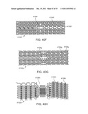 STENT ALIGNMENT DURING TREATMENT OF A BIFURCATION diagram and image