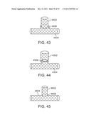 STENT ALIGNMENT DURING TREATMENT OF A BIFURCATION diagram and image