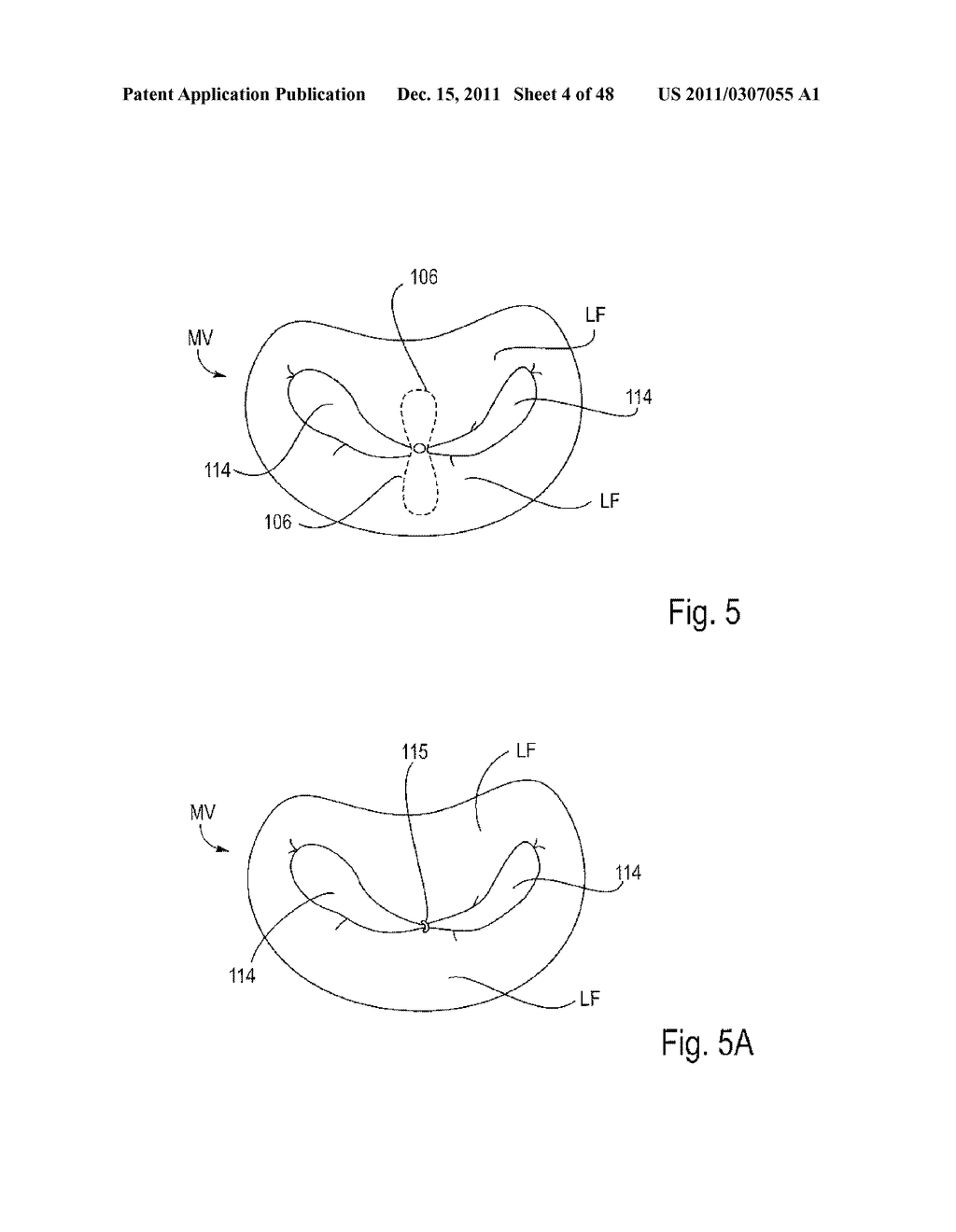 METHODS AND DEVICES FOR CAPTURING AND FIXING LEAFLETS IN VALVE REPAIR - diagram, schematic, and image 05