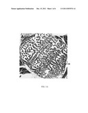 BIOMATERIALS FOR USE IN METHODS OF BONE REPLACEMENT THERAPY diagram and image