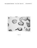 BIOMATERIALS FOR USE IN METHODS OF BONE REPLACEMENT THERAPY diagram and image