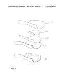 LOCALIZED REINFORCEMENT FOR LAMINATED PANEL E.G., FOR A PROSTHESIS diagram and image