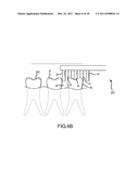 Oral Brushing Devices and/or Methods diagram and image