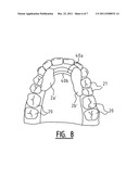 Apparatus for Clamping on the Lower or Upper Teeth, and Activator     Comprising Such an Apparatus diagram and image