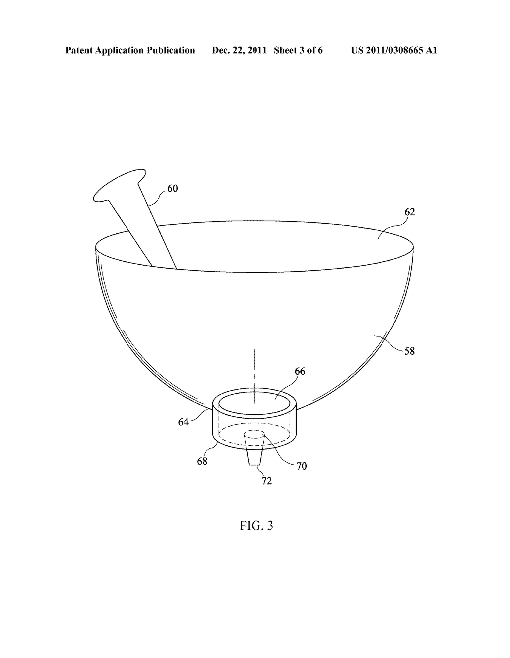 BONE REPLACEMENT MATERIAL MIXING AND DELIVERY DEVICES AND METHODS OF USE - diagram, schematic, and image 04