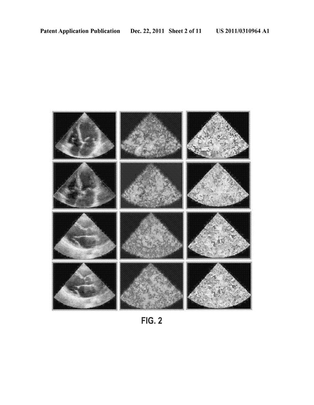 ECHOCARDIOGRAM VIEW CLASSIFICATION USING EDGE FILTERED SCALE-INVARIANT     MOTION FEATURES - diagram, schematic, and image 03