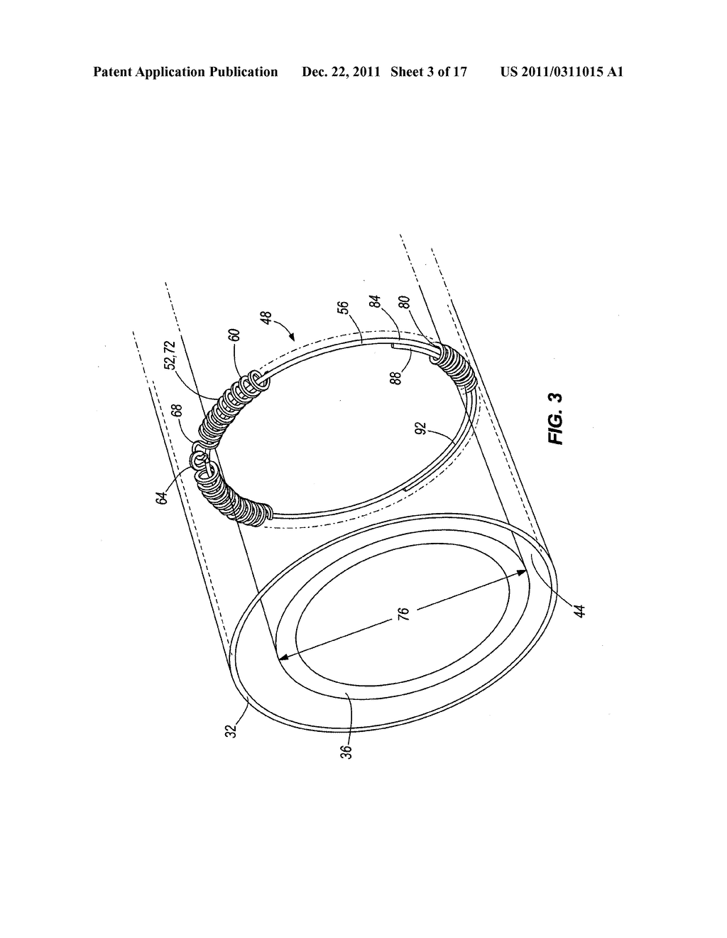 FUEL CHANNEL ANNULUS SPACER - diagram, schematic, and image 04