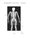 MEASURING INTRAMUSCULAR FAT diagram and image