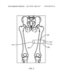 MEASURING INTRAMUSCULAR FAT diagram and image