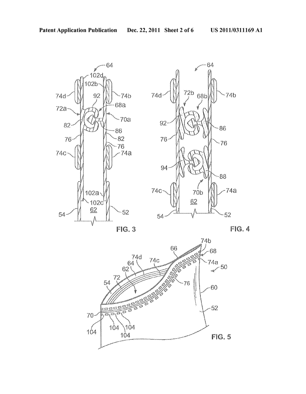 Tactile enhancement mechanism for a closure mechanism - diagram, schematic, and image 03